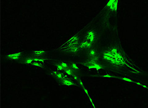 Learn more about the Neuroscience & Alzheimer's research focus